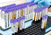 Vivia Biotech busca acelerar el diagnóstico en leucemia