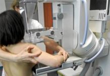 La oncología levanta nuevas barreras al cáncer de mama