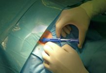 Implantan el aparato más pequeño de monitorización cardiaca