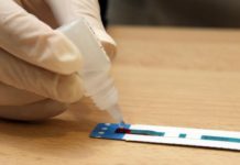 Diez nuevas farmacias vascas se suman al programa del test rápido del VIH