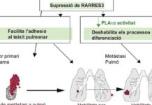 La pèrdua de RARRES3 promou la metàstasi de mama a pulmó
