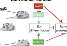 LOXL2 participa en la progresión de carcinomas escamosos