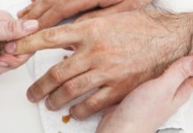 Los cuidados de la piel son claves en el paciente oncológico