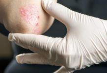 El mercado de dermatología crecerá un 7,7% hasta 2022