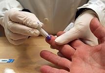 La botica es un aliado más en la prevención del VIH