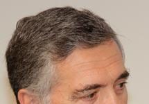 La frase de la Semana: “Quizá habría que revisar el RD 5/2000, pero cualquier decisión que pueda elevar la factura farmacéutica es difícil que surja”