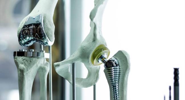 Las sustituciones de cadera y rodilla aumentan con la edad y son más costosas