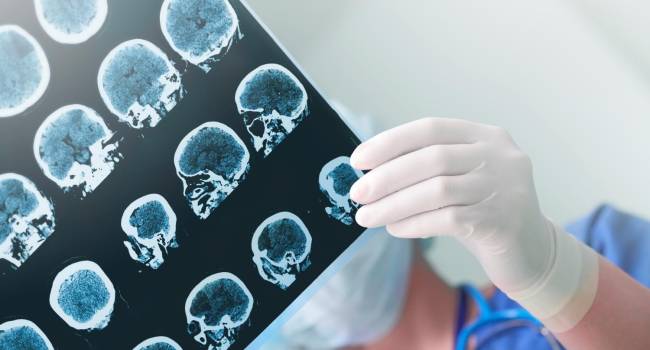 El CHMP emite una opinión positiva sobre Epidyolex