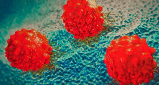 La FDA otorga prioridad de revisión a polatuzumab vedotin para linfoma