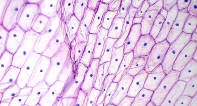 Los pacientes con mastocitosis sistémica avanzada cuentan ya con una terapia dirigida que alarga su supervivencia