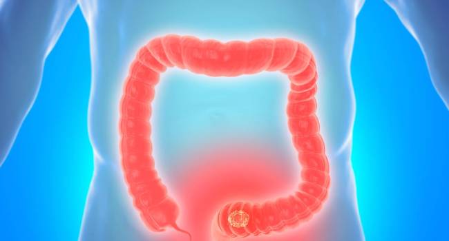 Dos genes parecen ayudar a las células madre en el intestino a quemar la grasa de la dieta