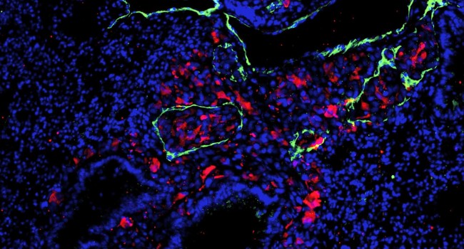 Visualizan en ratones las metástasis del melanoma antes de que se produzcan