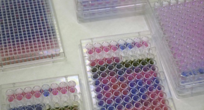 La Fundación Medina contará con el mayor banco de cultivos microbianos gracias al apoyo de MSD
