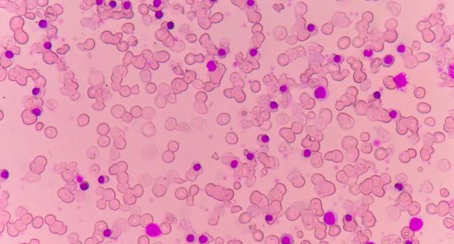 CSL Behring lanza el primer tratamiento de cadena única para la Hemofilia A en España
