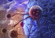La tremenda carga del cáncer que lo convierte en un asunto de Estado