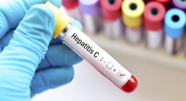 Consenso para el diagnóstico de la infección activa por hepatitis C en un único paso