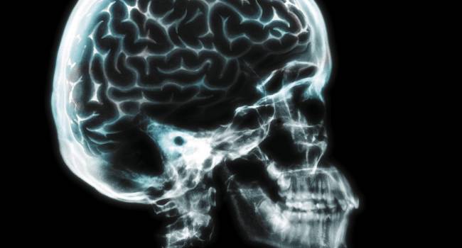 Reducir la polución ambiental frenaría el aumento de casos de enfermedades cerebrovasculares y neurodegenerativas
