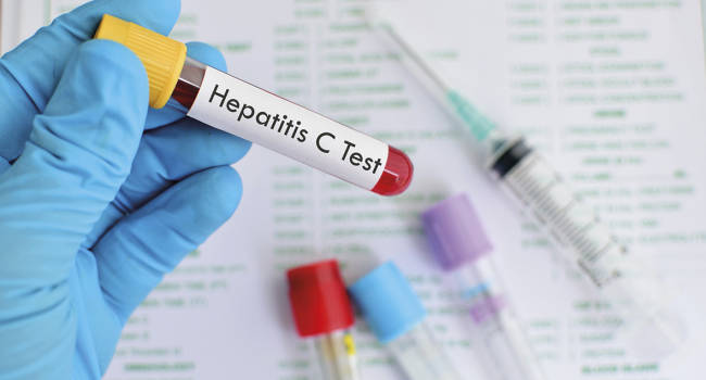 La prevención, clave del trabajo que queda por hacer ante la infección por VHC