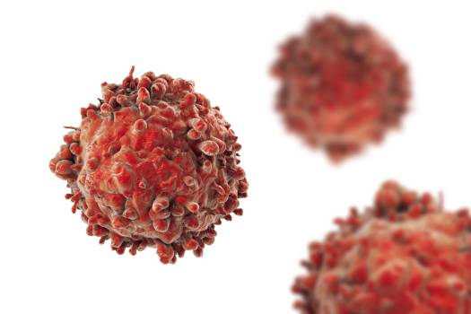 La UE autoriza Vyxeos para ciertos tipos de leucemia mieloide aguda de alto riesgo