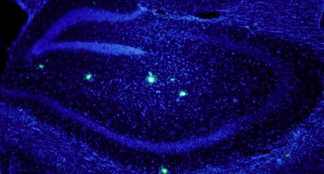 Desarrollan una estrategia para obtener agregados de beta amiloide que podrían causar muerte neuronal en alzhéimer