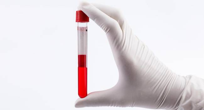 Un análisis de sangre adelantaría el diagnóstico del cáncer de pulmón no microcítico