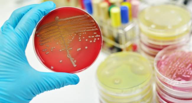 Logran combinar antibióticos y probióticos para erradicar dos cepas de bacterias resistentes