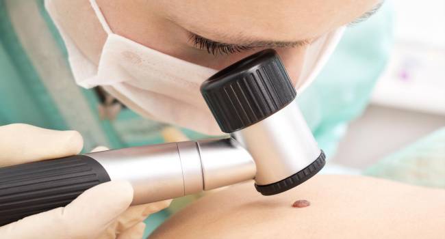 La suma de Opdivo y Yervoy aumenta la supervivencia en pacientes de melanoma