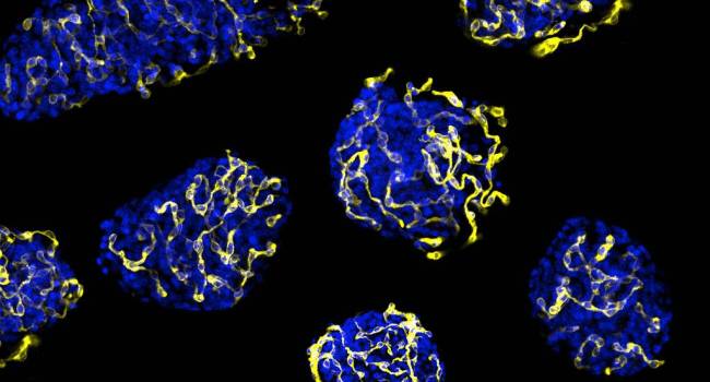 Identifican un mecanismo para mejorar el trasplante de islotes pancreáticos en diabetes tipo 1