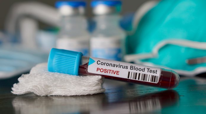 Disponible una prueba diagnóstica de Roche frente al Covid-19