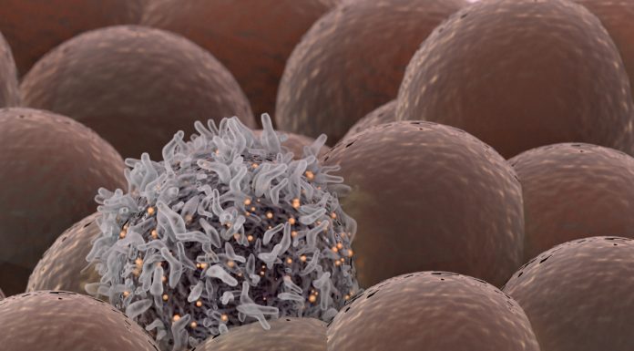 La inmunoterapia con TIL muestra avances en melanoma