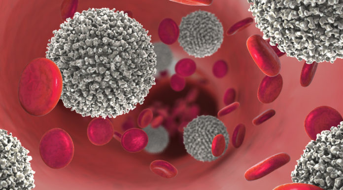 La CE aprueba Venclyxto con obinutuzumab en LLC no tratada previamente