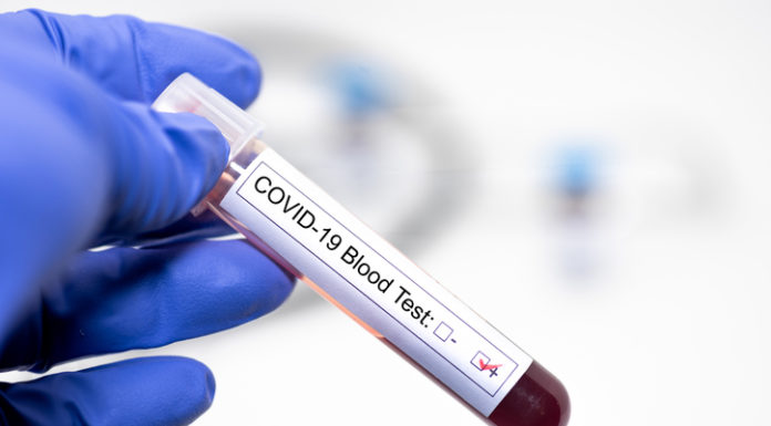 La FDA permite realizar tests de coronavirus antes de la revisión regulatoria