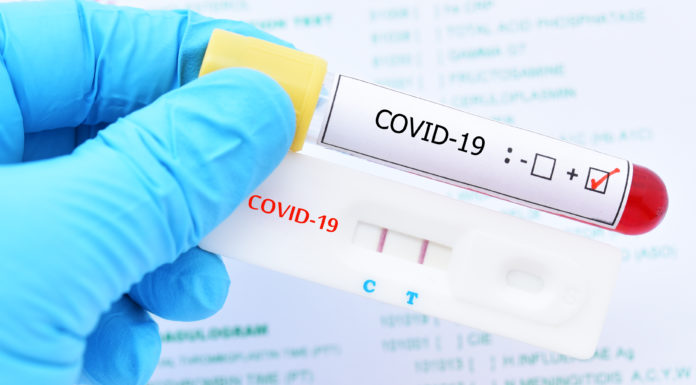 ¿Qué diferencia hay entre las PCR y los test rápidos para el diagnóstico del Covid-19?