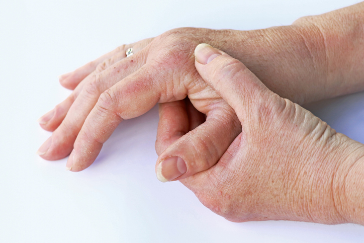 An elderly woman has pain in her hands