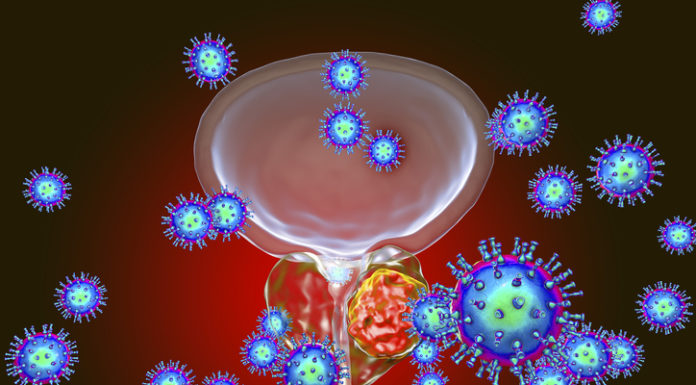 La CE aprueba un nuevo tratamiento para el cáncer de próstata resistente a la castración no metastásico