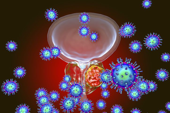 Conceptual image for viral ethiology of prostate cancer