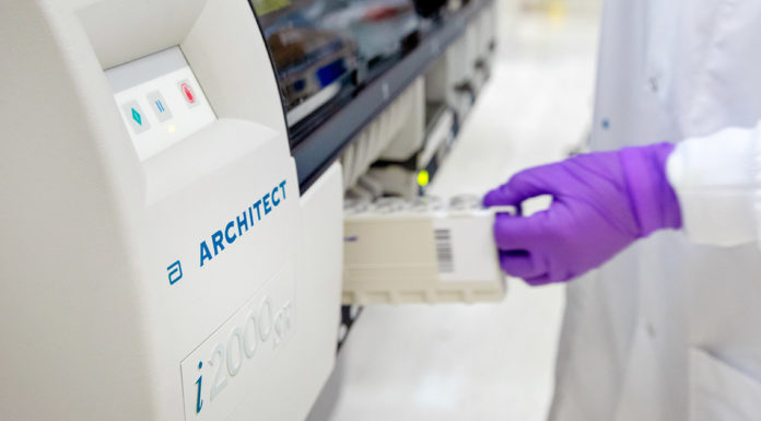 Abbott anuncia que ya está disponible en España su test de detección de anticuerpos