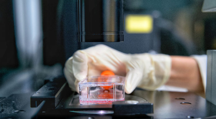 La FDA designa terapia avanzada a Kymriah para linfoma folicular