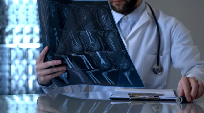 Los pacientes reumatológicos denuncian la falta de medicamentos para tratar su enfermedad