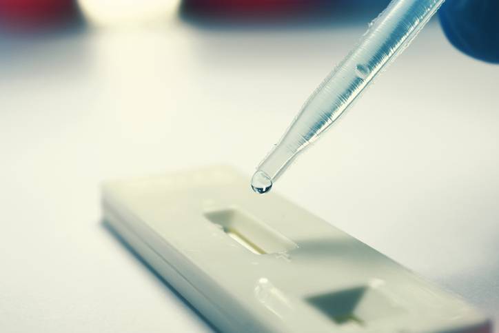 Rapid Test with pipette dropping analysis fluid