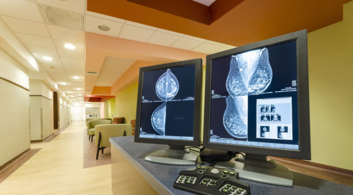 Kisqali muestra mejoras en la supervivencia en cáncer de mama avanzado HR+/HER2-