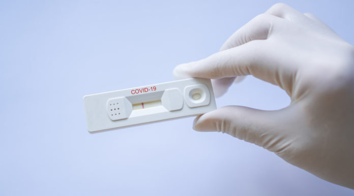 Los farmacéuticos se forman (por si acaso) para hacer test de la Covid-19 test covid