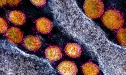 Investigadores del CSIC buscan una vacuna que usa un antígeno del coronavirus para estimular la inmunidad