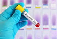 Los test de coronavirus a los farmacéuticos los harán las CC.AA.