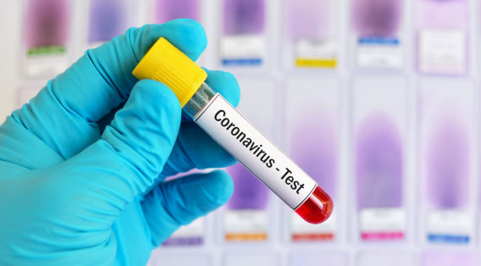 Los test de coronavirus a los farmacéuticos los harán las CC.AA.