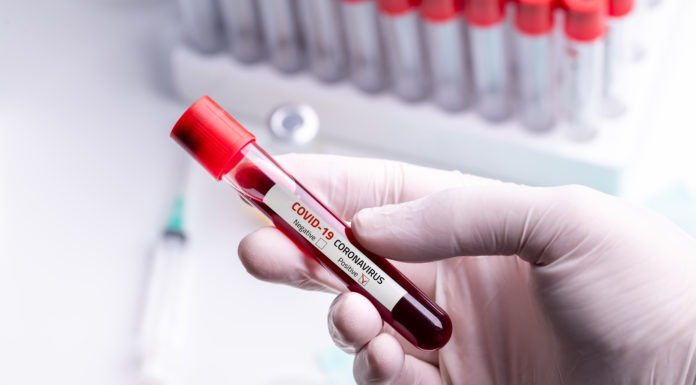 La FDA autoriza la terapia con plasma de pacientes recuperados para tratar la Covid-19
