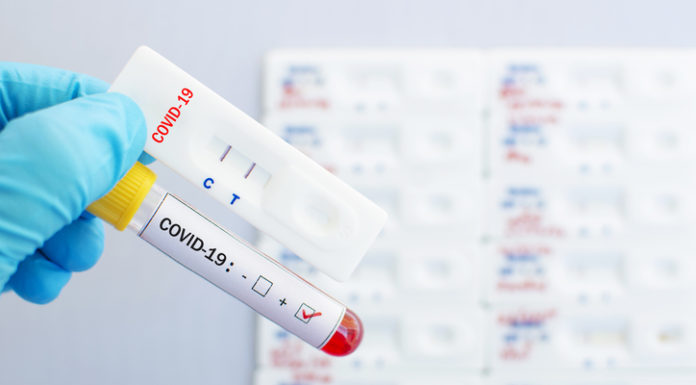 Roche lanzará una prueba rápida de antígenos en los países que acepten el marcado CE