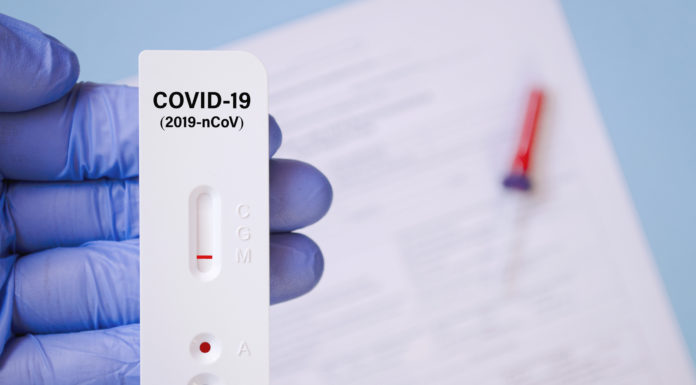 Test de antígenos para diagnosticar la COVID-19 y cuarentenas de 10 días, novedades que marca Sanidad