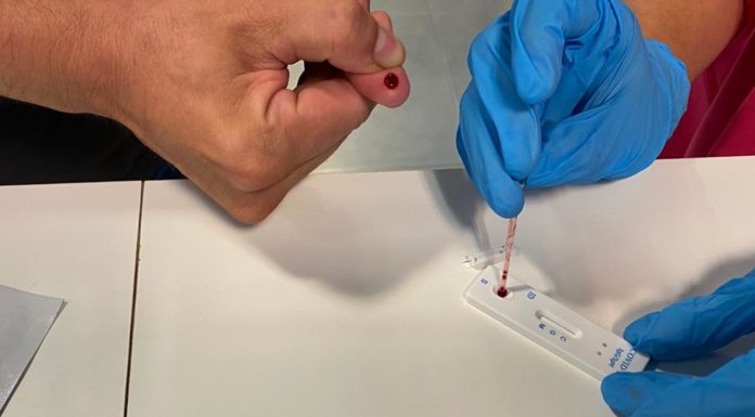 Respuestas a las ‘dudas’ de Simón: Sefac forma desde mayo en la realización de test de COVID-19 test COVID-19