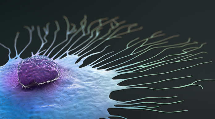 I+D, detección precoz y nuevas terapias: fórmula contra el cáncer de mama